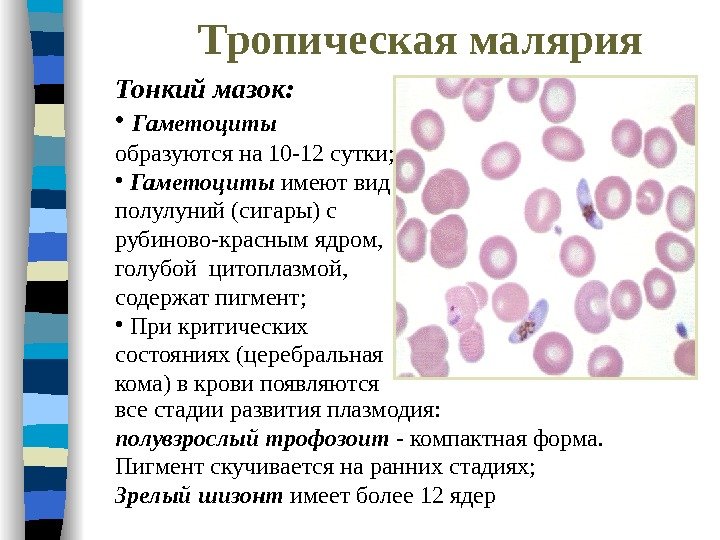 Тропическая малярия Тонкий мазок:  •  Гаметоциты  образуются на 10 -12 сутки;